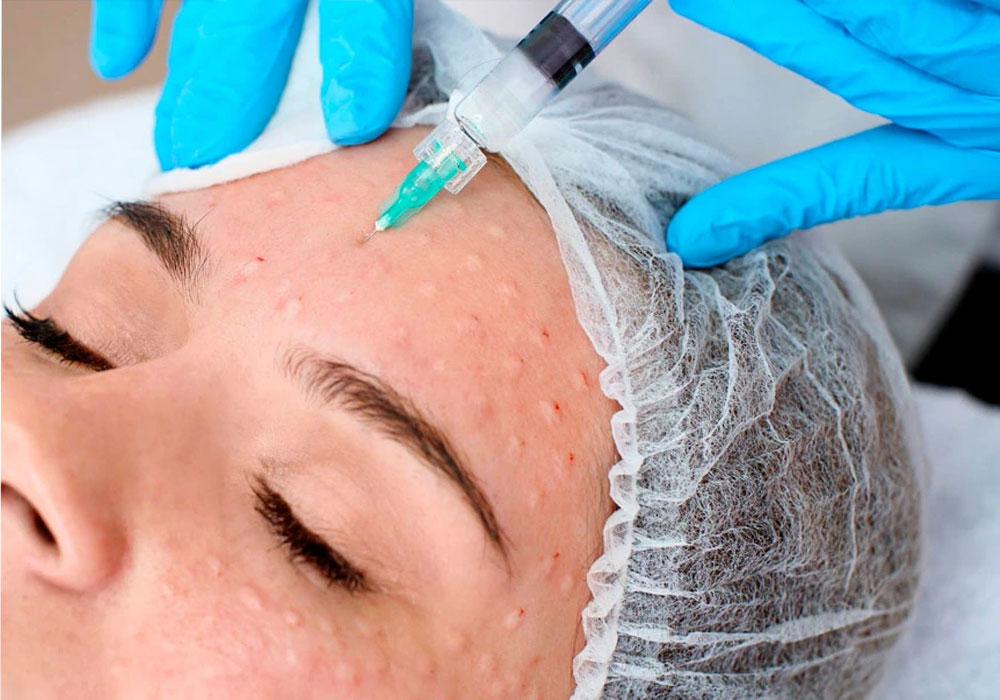 БИОРЕВИТАЛИЗАЦИЯ